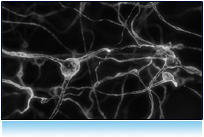 Computer Generated Neurons - nerve cells, brain cells, electric impuls